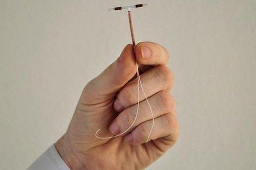 Vòng tránh thai đi lạc chỗ - Chú ý những bất thường để phát hiện sớm