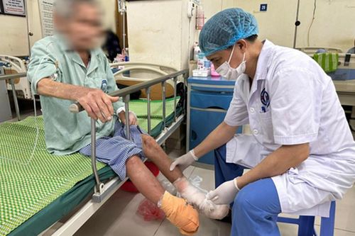 Cụ ông phải cắt bàn chân vì chủ quan với vết bầm tím nhỏ