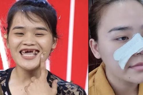 Ngân Thảo khác lạ sau khi trùng tu nhan sắc