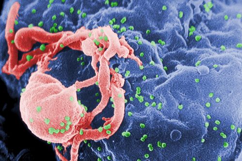 Bệnh nhân được chữa khỏi HIV nhờ ghép tế bào gốc