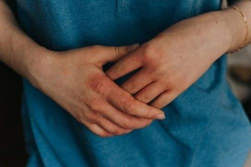 Ai có nguy cơ mắc bệnh ghẻ?