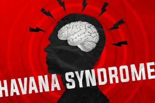 Sau hơn 6 năm điều tra, tình báo Mỹ ra kết luận về 'hội chứng Havana' bí ẩn
