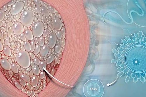 Chửa trứng nhưng nghĩ tiền mãn kinh không đi khám, bác sĩ chỉ cách phân biệt