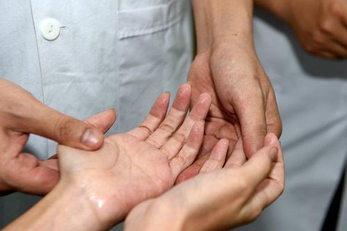 Phương pháp chữa ra nhiều mồ hôi tay, mồ hôi nách
