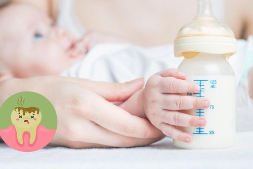 Cho trẻ bú bình có phải nguyên nhân gây sâu răng?
