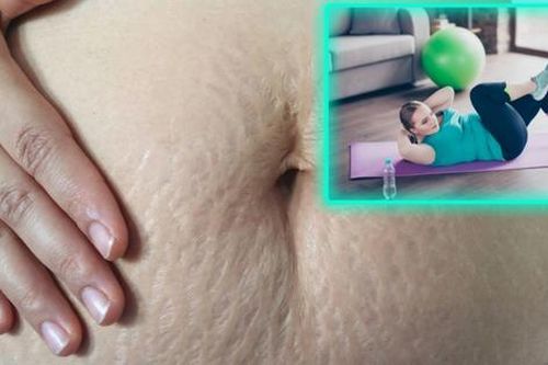 Sai lầm của chị em muốn phục hồi cơ bụng sau sinh để bụng phẳng, eo thon