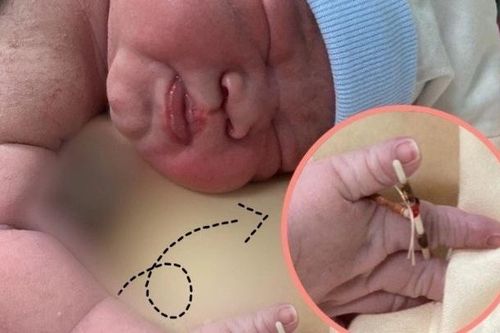 Bé gái chào đời kỳ diệu, chỉ gặp ở 2% phụ nữ trên thế giới
