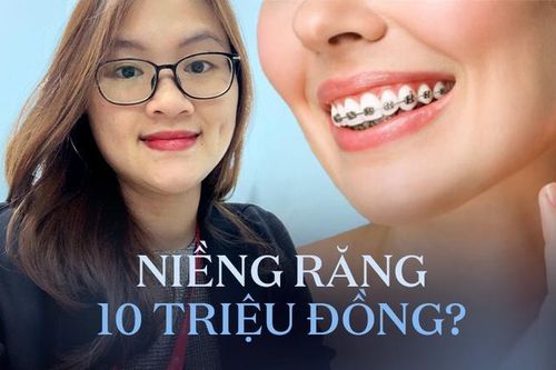 Cơn sốt 'Niềng răng từ A đến Z giá rẻ dưới 10 triệu đồng', bác sĩ cảnh báo