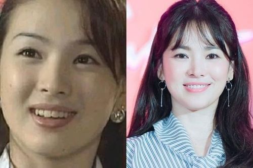 Song Hye Kyo, Lâm Tâm Như thăng hạng nhan sắc nhờ niềng răng