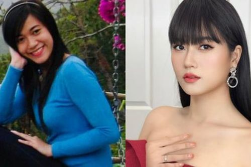 Lâm Vỹ Dạ thay đổi ra sao mà liên tục vướng nghi vấn can thiệp thẩm mỹ?