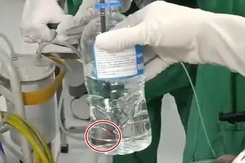 Gắp đỉa sống trong khí quản bệnh nhân