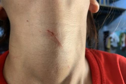 Bắt đối tượng kề dao khống chế cô gái trẻ để cướp đôi bông tai