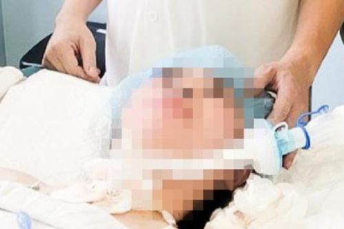Đi khám vì ho, khó thở, cô gái 17 tuổi bất ngờ phát hiện mắc u khí quản hiếm gặp