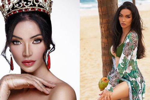 Tuổi thơ bất hạnh, bị kỳ thị của tân Hoa hậu Chuyển giới Brazil