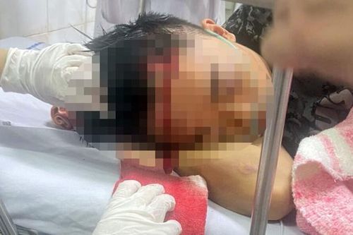Điều tra vụ việc 40 thanh thiếu niên 'hỗn chiến' trong đêm ở TP Hải Phòng