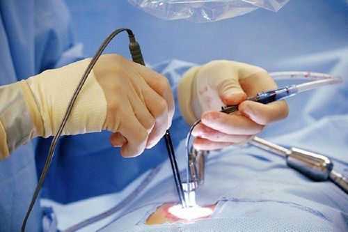 Bất ngờ cao thêm 45cm sau phẫu thuật khối u não