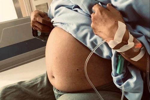Tưởng béo bụng người phụ nữ không ngờ mang khối u 10 kg