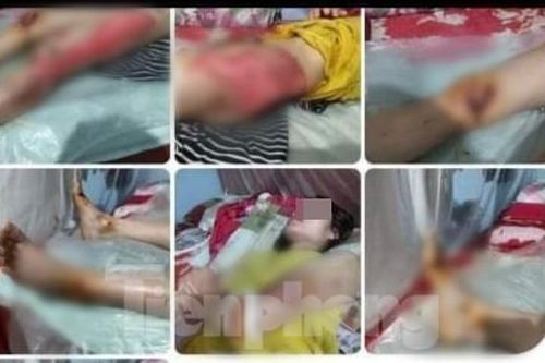 Thực hư tin 'con dùng xe máy kéo lê mẹ đẻ trên đường' ở Yên Bái