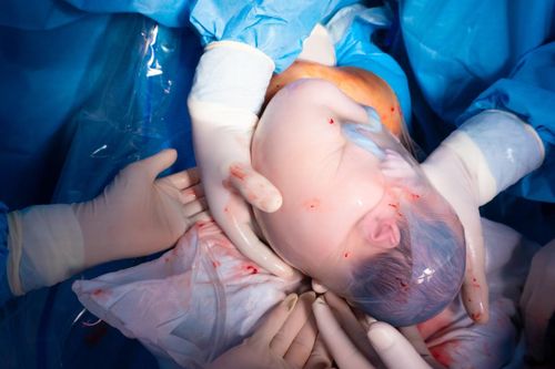 Có thể lựa chọn sinh con 'bọc điều' không?