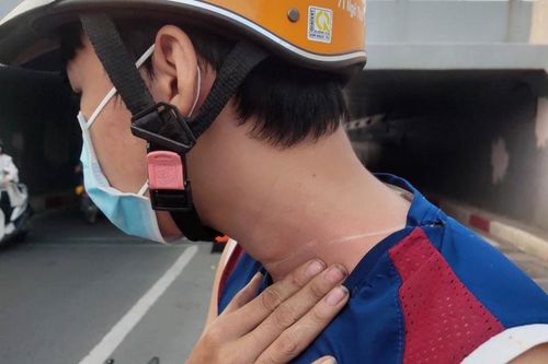 Người dân bức xúc vì bị dây diều cứa vào cổ, ngã xuống đường gây thương tích