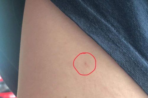 Xác minh thông tin 'em trai bị 2 người phụ nữ chích kim tiêm… khi đi dạo ở khu Sala'
