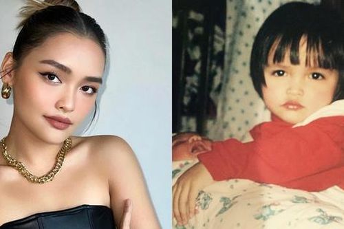 Linda Ngô khoe ảnh hồi nhỏ, phủ nhận sửa 1 điểm trên mặt