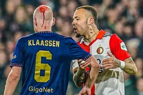 Sao Ajax chảy máu khi trúng vật thể lạ ở Siêu kinh điển Hà Lan