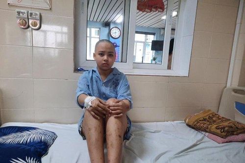 MS 837: Nữ sinh nghèo nguy cơ phải cưa chân vì mang bệnh nặng cần trợ giúp