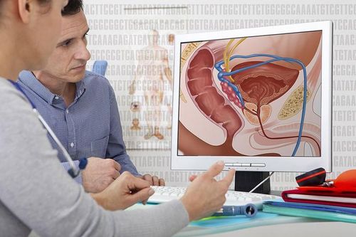 Đã tìm ra phương pháp mới điều trị ung thư tuyến tiền liệt