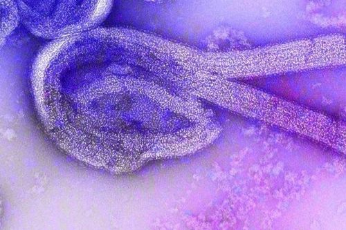 HCDC cảnh báo các triệu chứng khi nhiễm virus Marburg