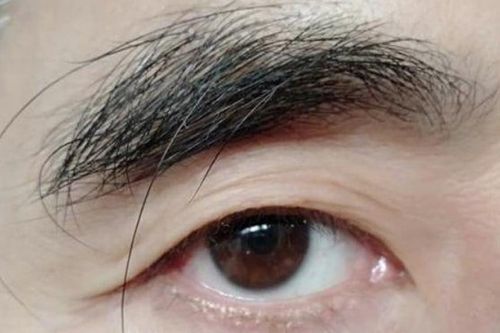 Sau tuổi 30 nếu thấy lông ở vị trí này dài ra thì đó là dấu hiệu của sự trường thọ