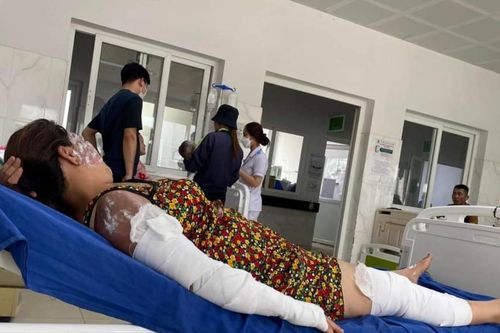 4 nạn nhân vụ nổ bình ga mini khi ăn lẩu vẫn chưa được xuất viện