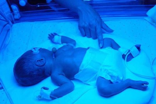 FDA rút giấy phép đối với thuốc ngăn ngừa sinh non