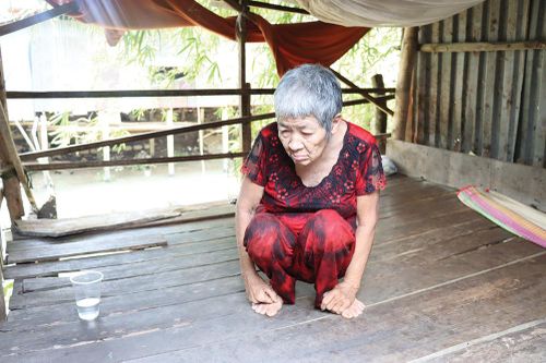 Trẻ bị não úng thủy và cụ già neo đơn cần giúp đỡ