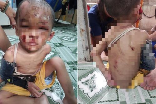 Kết quả điều tra ban đầu vụ bé trai nghi bị bạo hành ở Hóc Môn
