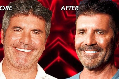 Simon Cowell lên tiếng về gương mặt khác lạ