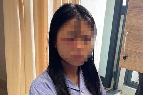 Giám định thương tích nữ sinh lớp 8 bị đánh hội đồng