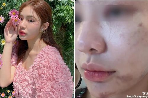 Loạt nghi vấn trước cái chết của nữ ca sĩ 19 tuổi, từng bị bạn trai bạo hành