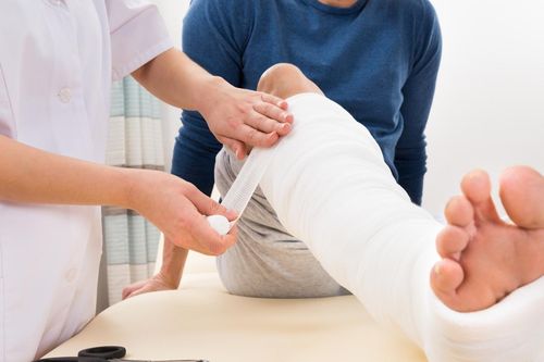 Chân ngắn, chân dài sau khi bó bột chữa gãy xương