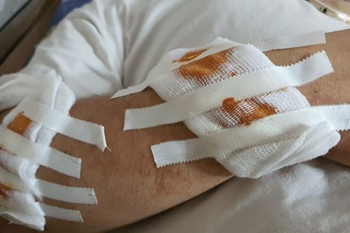 Bắt 2 đối tượng vụ hô 'chém chết' người trong đêm ở Hà Nội
