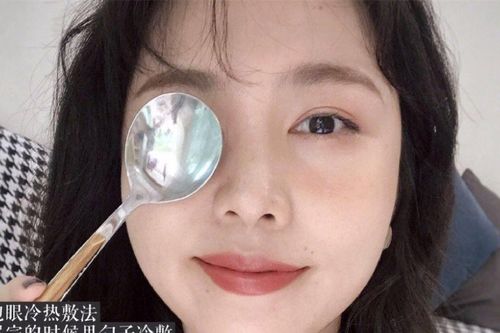 Đánh bay bọng mắt và quầng thâm sau 1 tuần với 5 cách không tốn 1 xu