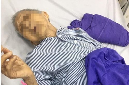 Hiếm gặp: Cụ bà 104 tuổi người dân tộc thiểu số bị thoát vị bịt được bác sĩ cứu sống