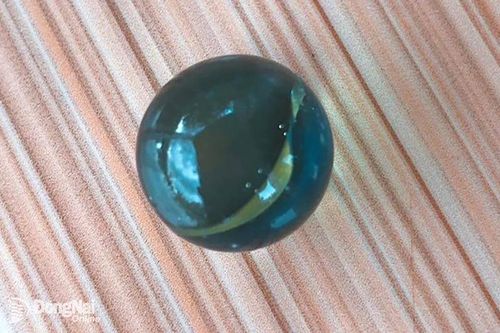 Cấp cứu bé trai 5 tuổi nuốt viên bi vào dạ dày