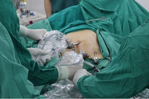 Đi khám vì đau mạn sườn, người đàn ông phát hiện mắc ung thư