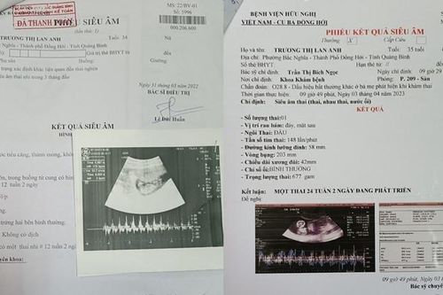 'Siêu lừa' Lan Anh: 8 lần xin hoãn thi hành án, 6 lần mang thai không sinh con