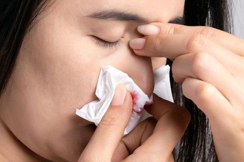 Lý do khiến người phụ nữ chảy máu mũi liên tục suốt 7 ngày