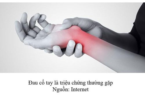 Hội chứng ống cổ tay và những thông tin cần biết