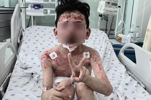 Bé trai 8 tuổi mắc bệnh nguy hiểm sau 2 ngày ăn cua