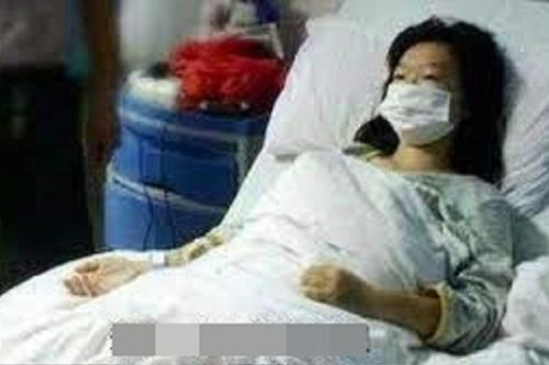 Thiếu nữ 16 tuổi mắc ung thư dạ dày giai đoạn cuối, cảnh báo 4 thói quen xấu mà người trẻ nào cũng mắc
