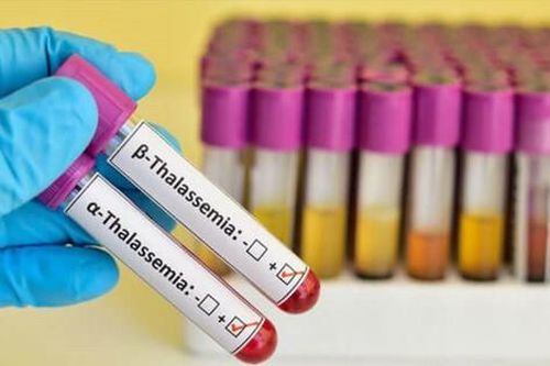 Ngăn chặn bệnh Thalassemia để không ảnh hưởng giống nòi